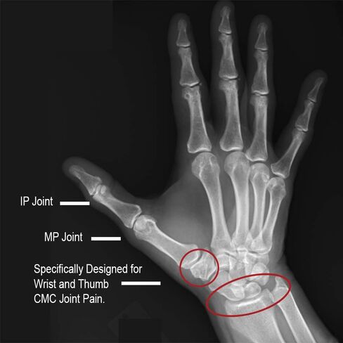 Comfort Cool Thumb CMC Restriction Splint, Provides Direct Support For The Thumb CMC Joint While Allowing Full Finger Function, Left Hand, Large Plus in Kuwait
