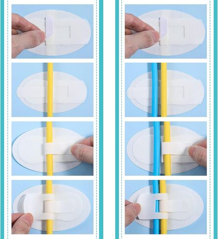 30PCS Catheter Stabilization Devices Catheter Tube Holder Urinary Stabilizer Adhesive Leg Bag Fixation Legband Holder Stickers Patch Accessories for Single Double Feeding G Tube in Saudi Arabia