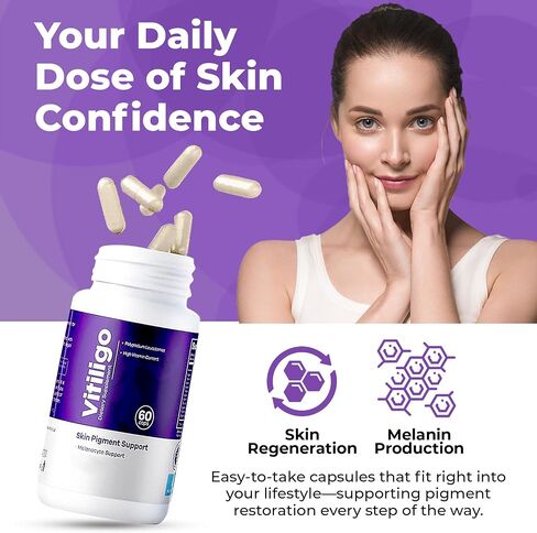 Vitiligo Capsules 60 Count | 1 Month | Improve Skin Pigmentation Support and Reduce White Spots | Effective Vitiligo Supplement | Natural Solution for White Spots on Skin. (1) in Saudi Arabia