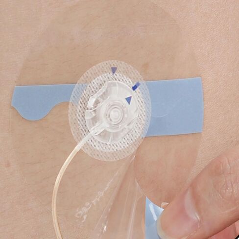 60Pcs Universal Adhesive Patches for CGM and Insulin Pumps, 0.8-Inch Hole, Breathable Clear Patches & Waterproof CGM Sensor Patches 10-14Day, CGM Protection, Pre-Cut Adhesive Tape, Skin-Friendly Patch in Kuwait