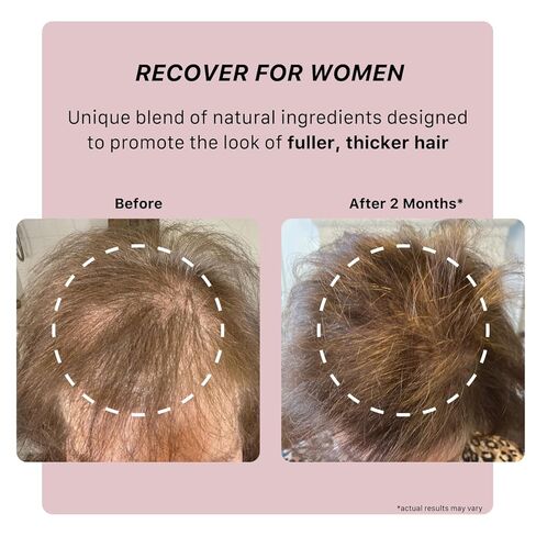 ACTIIV Recover Thickening Shampoo Treatment For Women | Supports the Appearance of Fuller, Healthier-Looking Hair, Supports Scalp Health, Plant-Based, Color-Safe, Vegan, All Hair Types in Kuwait