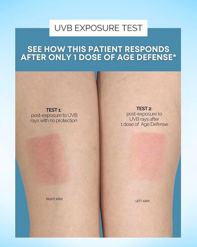 Age Defense Vitamins - Dermatologist and Plastic Surgeon Developed to Fight photoaging and Melasma, Polypodium Leucotomos Antioxidant Formula – Vegan, Gluten-Free – 60 Capsules in Saudi Arabia
