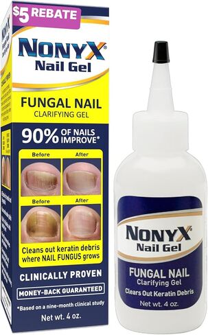 NONYX Fungal Nail Clarifying Gel | Rids Nails of Fungus by Removing Keratin Debris Where Nail Fungus Grows | 90% of Toenails Improved Using this Toenail Fungus Treatment | 4 oz in Saudi Arabia