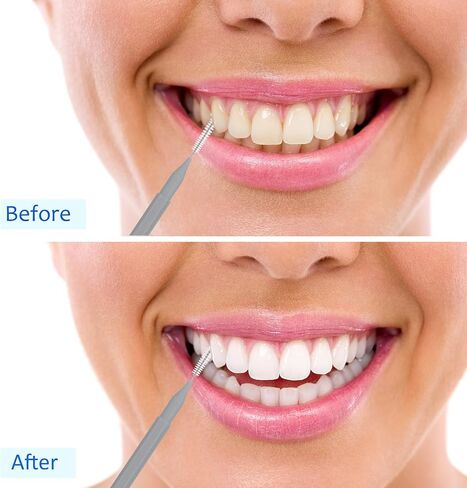 Patelai 100 Pieces Braces Brush for Cleaner Interdental Brush Toothpick Dental Tooth Flossing Head Oral Dental Hygiene Flosser Toothpick Cleaners Tooth Cleaning Tool(Bright Colors,Multiple Sizes) in Saudi Arabia