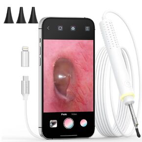 Otoscope for iPhone/Android, ScopeAround 3.9mm Ultra-Thin Ear Camera with 6 LED Lights, Digital Otoscope with Ear Wax Removal Tool, USB Plug & Play Ear Wax Camera for iPhone/Android (No Wi-Fi Needed)