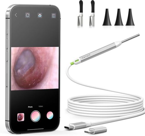 كاميرا أذن صغيرة بمنفذ USB، منظار الأذن الرقمي البصري Anykit بقطر 3.9 مم مع 6 مصابيح LED وأداة إزالة شمع الأذن للبالغين والأطفال، متوافقة مع iPhone وAndroid in Kuwait