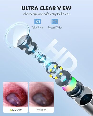 كاميرا أذن صغيرة بمنفذ USB، منظار الأذن الرقمي البصري Anykit بقطر 3.9 مم مع 6 مصابيح LED وأداة إزالة شمع الأذن للبالغين والأطفال، متوافقة مع iPhone وAndroid in Kuwait
