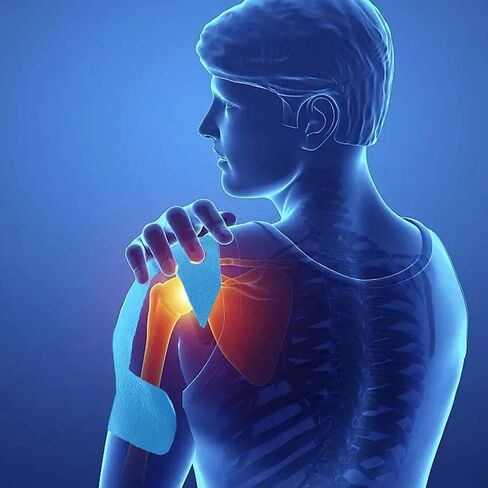 شريط علم الحركة للكتف، 10 قطع، أزرق in Kuwait