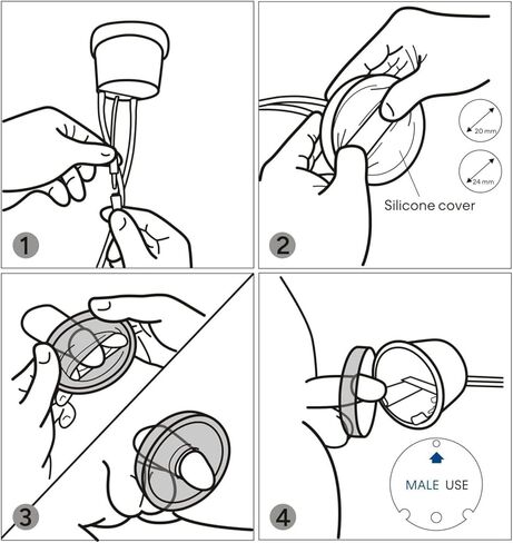 نظام جمع البول القسطرة الخارجية لاستخدام الذكور ، جمع جامع البول غير الغازي الحساس ، وسرير الراحة المضادة للتسرب ، ومسالس البول. in Kuwait