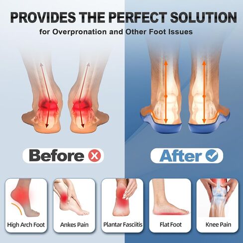 orthocomfoot أخمصي التهاب اللفافة الراحة الراحة: انخفاض الحذاء دعم الحذاء للرجال للنساء ، العمل الثقيل من السائر العظمية العظمي للوقوف طوال اليوم ، حجم 11 رجال/13 امرأة in Kuwait