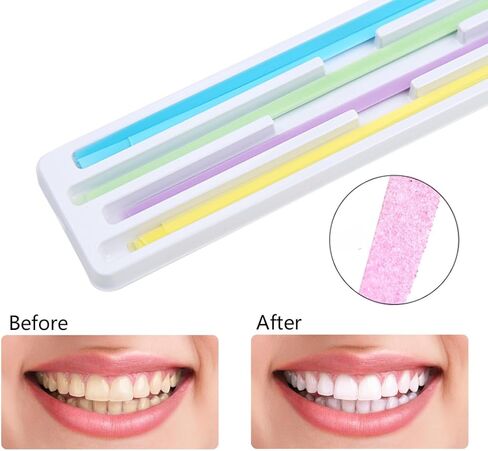 Dental Polishing Strips Tooth File Teeth Whitening Oral Care 4mm x 6m Tooth Sandpaper 2 Roll 2 Grint（Blue Fine+Pink Coarse） in Saudi Arabia