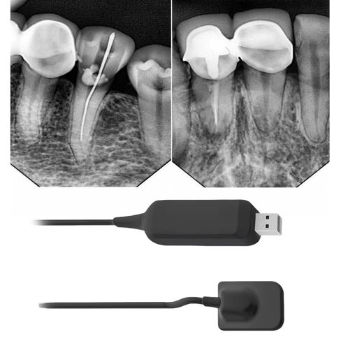 Digital Intra-Oral Sensors, Black, Dimensions:23.4 × 33.6 × 4.5mm, Pixel Pitch: 20 μm (#Pluto 0000X), Sold by JMU in Saudi Arabia