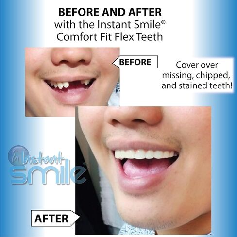 Smile Smile Flex Teath (الظل الطبيعي) ومجموعة أسنان سلسلة Pro Series - 2 منتجات Smile رائعة in Kuwait