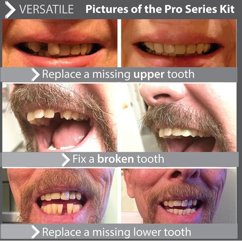 Smile Smile Flex Teath (الظل الطبيعي) ومجموعة أسنان سلسلة Pro Series - 2 منتجات Smile رائعة in Kuwait