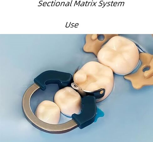نظام مصفوفة الأسنان ، R6 Nickel Titanium Dental Clamp Clamp Clamp ، حلقة مصفوفات محيطية ، أدوات طب الأسنان القابلة للتوسعة in Kuwait