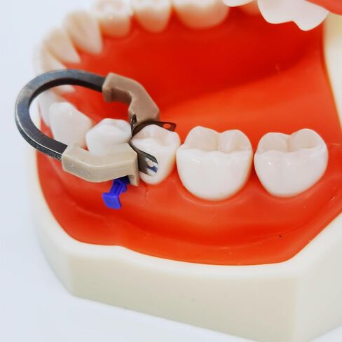 نظام مصفوفة الأسنان ، R6 Nickel Titanium Dental Clamp Clamp Clamp ، حلقة مصفوفات محيطية ، أدوات طب الأسنان القابلة للتوسعة in Kuwait