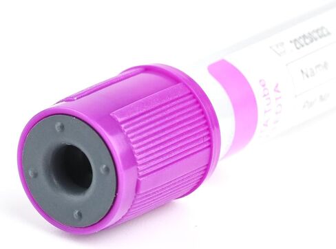 Vacutainer Blood Collection Tubes 5ml Plain Tube Vacuum Collecting Lab Tube for Lab Test Tubes Pet Animals Veterinary 100 Pcs Wrap Packaging in Kuwait