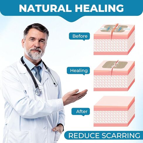 Emergency Wound Closure Strips: Adjustable High Adhesivas & Customized Skin Tones Zip Stitch Band & Butterfly Bandaids Without Stitches Easy to Use Quick Clot Laceration Closure Device in Kuwait