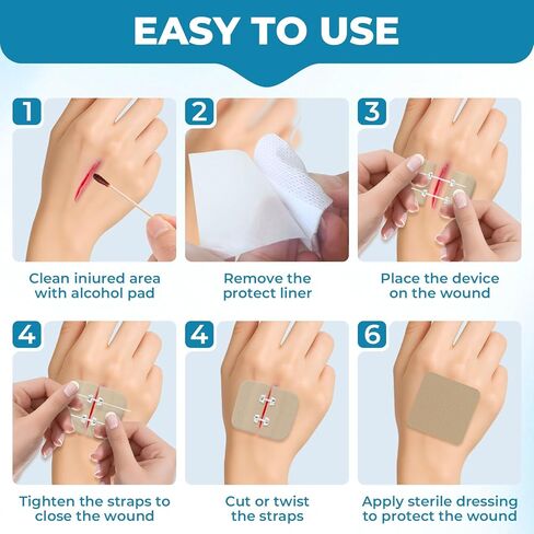 Emergency Wound Closure Strips: Adjustable High Adhesivas & Customized Skin Tones Zip Stitch Band & Butterfly Bandaids Without Stitches Easy to Use Quick Clot Laceration Closure Device in Kuwait