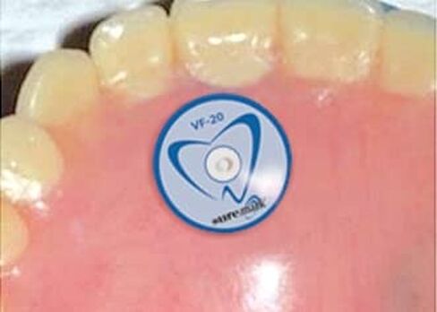 علامات الجلد Dentalmark على ملصق بحجم الأسنان - 2.0 مم كرة غير معدنية ، 110 لكل صندوق in Kuwait