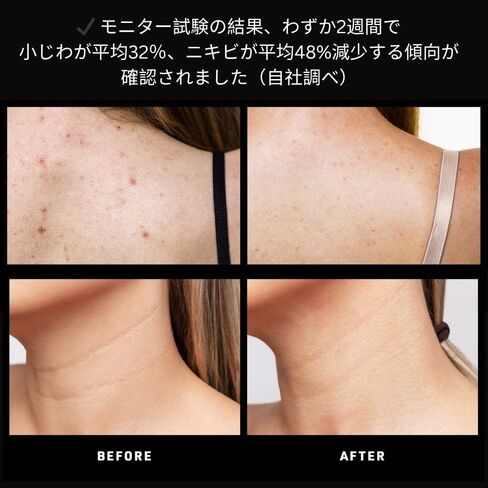 FAQ 211-8 Light Neck & Décolleté Mask - Wireless & Lightweight Silicone Masks - Flexible-Fit & Full Coverage - Wearable Skin Care in Saudi Arabia