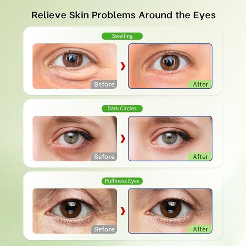 Gel Ice Pack Reusable Cooling Eye Pads and Under Patches,Eye Hot Cold Treatment for Redness,Pain Relief Relax in Kuwait