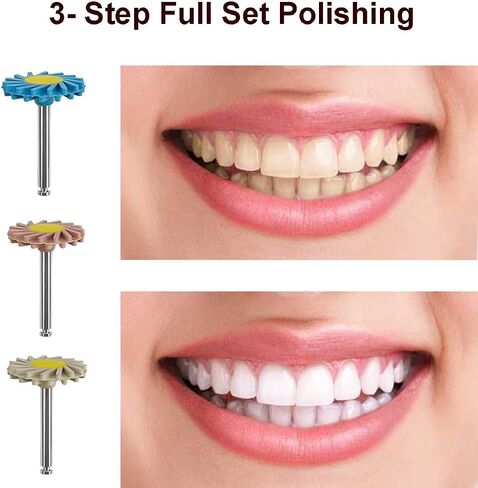 Dental Composite Resin Polishing P3 Disc Polisher Wheels Diamond 3-Step Diamond Impregnated Polishing System System 14mm Wheel Kit Spiral Flex Brush Tools in Kuwait