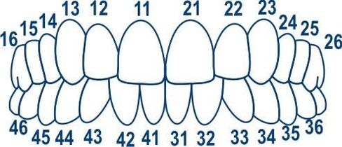 1.911 مصفوفات التيجان شفافة الأسنان مصفوفة 64 PCS/Pack (الخلفي) Tor VM in Saudi Arabia