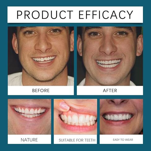 مجموعة أسنان قابلة للتعديل ، أعلى وأسفل مع GUTTA-percha ، مجموعة كاملة in Kuwait