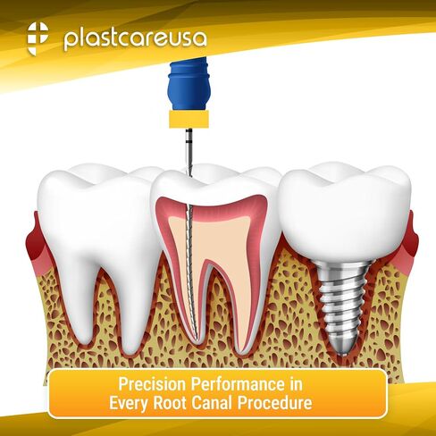 ملفات أسنان Endodontic 21mm endo H (3 حزم من 6) (18 ملفات Hedstrom من الفولاذ المقاوم للصدأ) (متنوعة #15 - #40) in Saudi Arabia