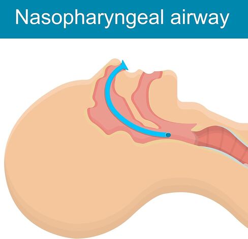 ASA Techmed Nasal Airway Kit 7 MM Medical Nashoparyspeal Management Management Airways - LIVER in Kuwait