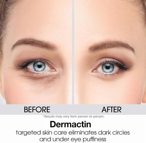 Dermactin-TS Upper Eyelid Cream 1 oz. Firms & Tones Sagging & Drooping Skin On Upper Eye Lids, for Younger, More Vibrant & Alert Appearance, for Sensitive Skin In The Eyelids in Saudi Arabia