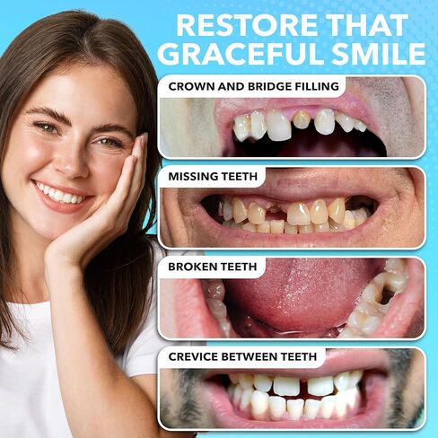 jj care repair kit kit zinc oxide eugenol dental exement ، kit kit kit reportor report touch for tooth ، strem for crown ، bridges and missing tustice in Saudi Arabia