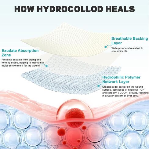 Hydrocolloid Bandages for Wound Care - Medical Grade Hydrocolloid Roll, Flexible & Waterproof Wound Cover, Home First Aid Kit Essential (2IN x 12FT) in Saudi Arabia
