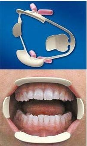 Premier Dental 9061381 Comfortview Lip & Cheek Retractors ، Universal ، 2/PK ، دعامات الشفاه المبطنة بالتوسي in Saudi Arabia