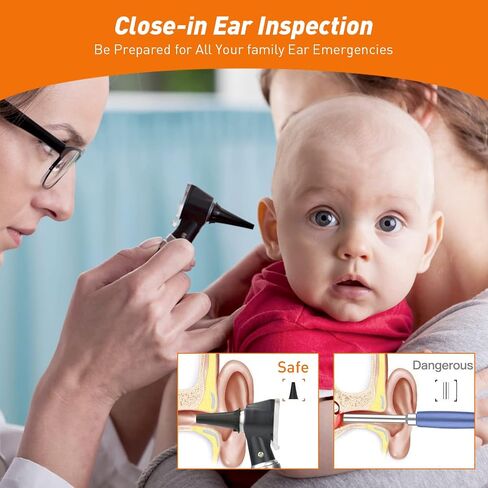 Scian Otoscope - Ear Scope with Light, Ear Infection Detector, Pocket Ear Checker Kit with 3X Magnify Lens & 8 Speculum Tips for Kids,Elders,Dogs,Home Use (Purple) in Kuwait