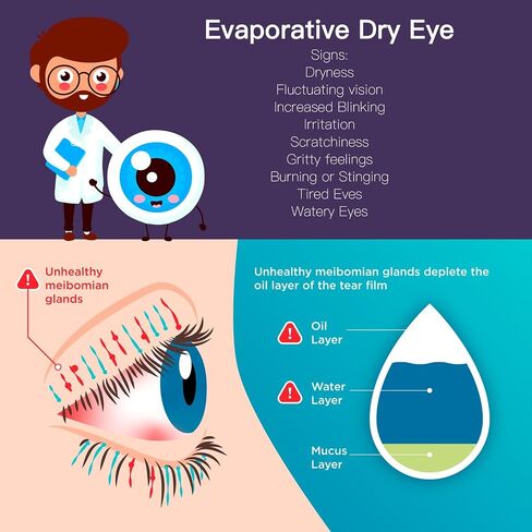 Cordless Heated Eye Mask for Dry Eyes，Washable Warm Eye Compress Mask for Stye Eye Treatment,Cornea Care Rest Self Electric Eyes Heating Pad Office Napfor Travel，Relief Blepharitis, Chalazion, MGD in Saudi Arabia
