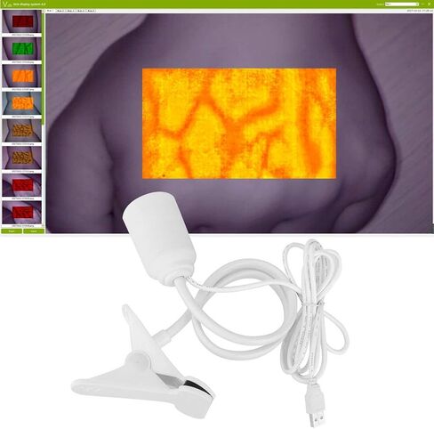مكتشف الوريد لاستئصال الفلبيوت - مشاهد الأشعة تحت الحمراء Transilluminator ، آلة العرض ، أداة مع تصوير الأضواء للبالغين والطفل in Kuwait
