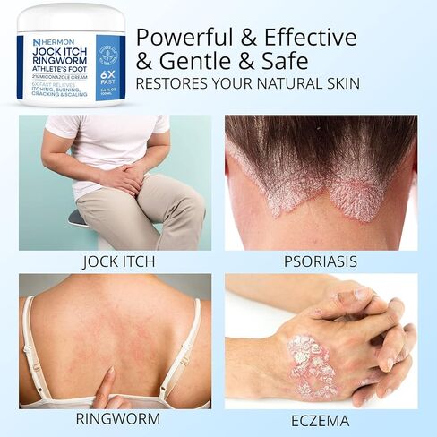 Jock Itch Antifungal Cream, Ringworm Treatment for Humans, Psoriasis Scalp Treatment, Ringworm Cream for Humans, Foot & Body Balm, Provides Soothing Relief-2 Pack in Saudi Arabia
