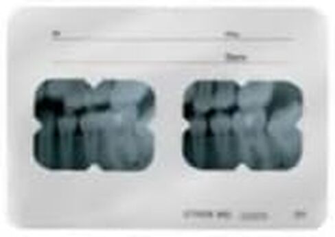 100/PK Flow Film Film Mount Grip Right Right Film Clear Film يركع نوافذ أفقية ورأسية بأحجام مختلفة (4-H (R)) in Saudi Arabia