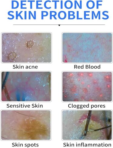 Scalp Analysis Machine, Wireless Skin Analyzer Machine, Skin Hair Analyzer, Multi-Function Tester, Skin Hair Follicle Scalp Detector, 3 Gears, 1 Megapixel, for Head Spa Home Salon Use in Saudi Arabia