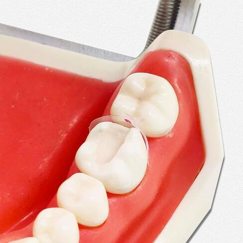 10 pcs/pack dental clear matrix الأمامي الخلفي الملاءمة الحيوية bt المصفوفات الشفافة الأسنان فئة القوس المولي استعادة مثلث أسود (حزمة 1 الفك السفلي الأمامي mesial) in Kuwait