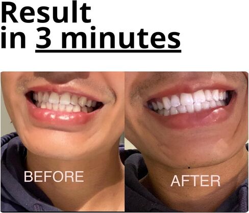 Teeth Whitening Foam with Purple Color Correcting Technology – 50ml Gentle Formula for Daily Use, Stain Removal, Mint Flavor, Safe for Sensitive Teeth, Enamel-Friendly Whitening in Saudi Arabia