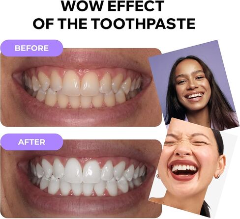 Teeth Whitening Foam with Purple Color Correcting Technology – 50ml Gentle Formula for Daily Use, Stain Removal, Mint Flavor, Safe for Sensitive Teeth, Enamel-Friendly Whitening in Saudi Arabia