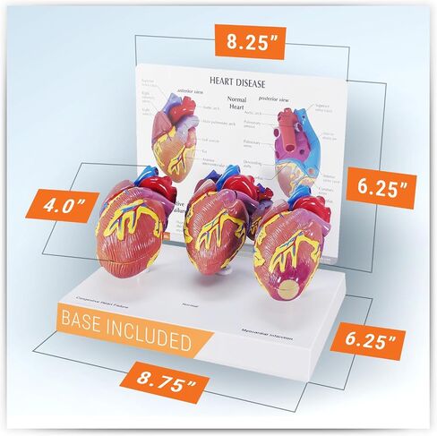 GPI Anatomicals - مجموعة نموذج القلب المصغرة المكونة من 3 قطع ، نماذج القلب الطبيعية والمرضية لتعليم التشريح وتعليم علم وظائف الأعضاء ، نموذج علم التشريح لمكتب الطبيب والفصول الدراسية ، وموارد التعلم الطبي in Kuwait