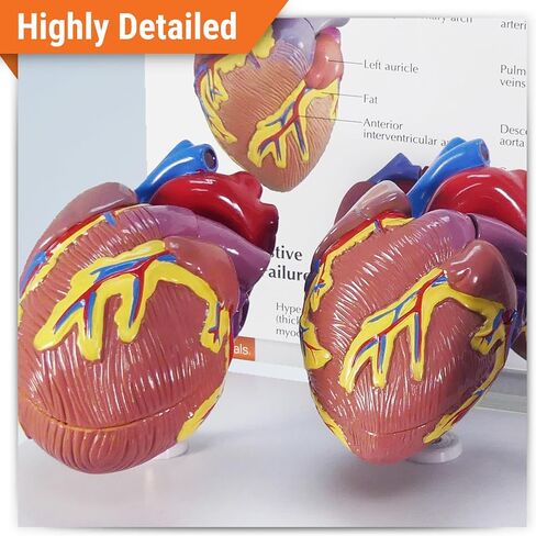 GPI Anatomicals - مجموعة نموذج القلب المصغرة المكونة من 3 قطع ، نماذج القلب الطبيعية والمرضية لتعليم التشريح وتعليم علم وظائف الأعضاء ، نموذج علم التشريح لمكتب الطبيب والفصول الدراسية ، وموارد التعلم الطبي in Kuwait