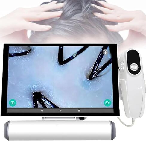 محلل شعر تشخيص الجلد ، عرض 11 بوصة محلل شعر مجهر HD (200x/50x) ، شاشة شاشة LCD للوجه ، رعاية فروة الرأس ، صالون تجميل ، الصفحة الرئيسية in Saudi Arabia