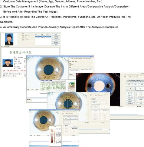 30X Iriscope Eye Analyzer - 8MP Iridology Camera with Dual Image Display for Beauty Salons & Hospitals - Professional Diagnostic Tool for Eye Health & Wellness in Saudi Arabia