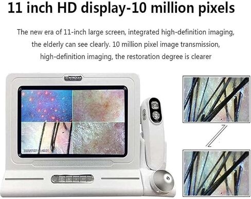 Skin Diagnosis Hair Analyzer, 11 Inch HD LCD Screen Skin Diagnosis Hair Analyzer Machine, 50x/200x DualHeads, 4 Screen Comparison for Home, Beauty Salon Spa in Saudi Arabia