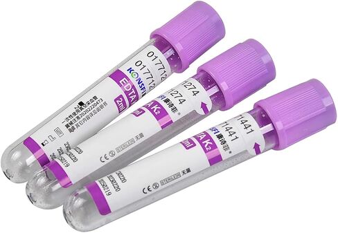 Veterinary Lab Vacuum Blood Collection Coagulation Tubes No Additive Tube Blood Collection Tube Pet Supplies, 5ml Red 100pcs in Kuwait